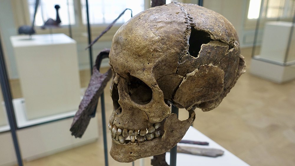 A damaged skull in an exhibition on a museum. Photo.